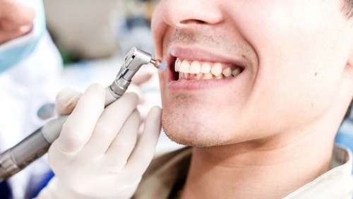стоматология чистка зубов